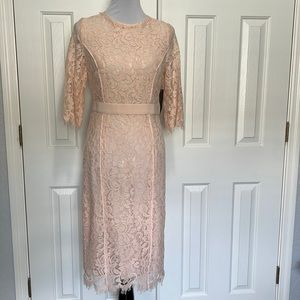 Stunning Eva Mendes Lace Dress